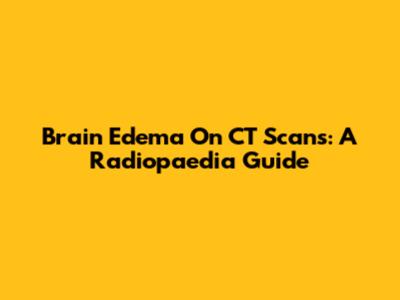 Brain Edema On CT Scans: A Radiopaedia Guide