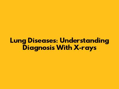 Lung Diseases: Understanding Diagnosis With X-rays