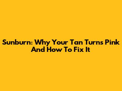 Sunburn: Why Your Tan Turns Pink And How To Fix It