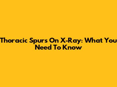 Thoracic Spurs On X-Ray: What You Need To Know